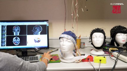 Desarrollan un implante para que las personas ciegas puedan mejorar su percepción visual