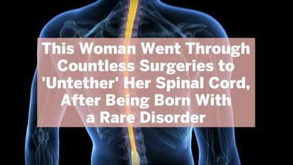 This Woman Went Through Countless Surgeries to 'Untether' Her Spinal Cord, After Being Born With a Rare Disorder