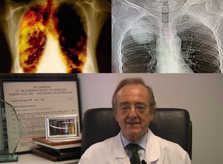 Noticias del Corazón: "El trabajo mixto cardio-oncológico que chequea enfermedades cardiovasculares"_