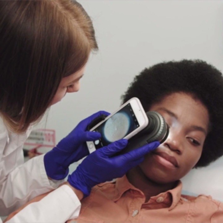 Everything You Need to Know About Mole Removal