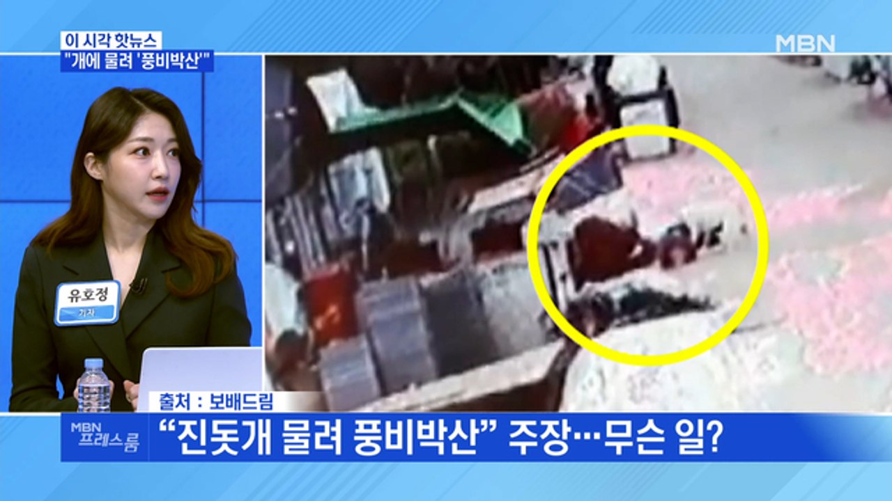 [MBN 프레스룸] "개에 물려 '풍비박산'"