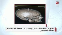 استخراج مسمار من جمجمة طفل بمستشفى ..د. عبدالرحمن الدنجاوي يكشف التفاصيل