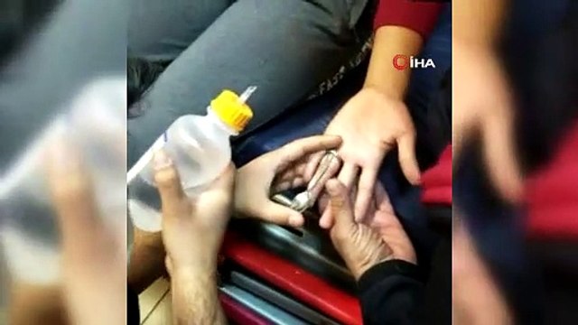 Parmağına sıkışan madeni paradan yaptığı yüzüğü itfaiye çıkarttı