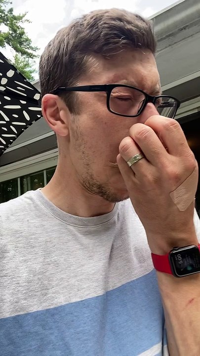 Bee Stings Man From Inside His Nostril