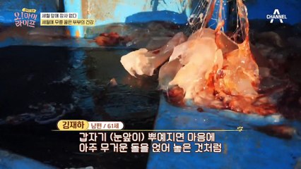 '먹고 사는게 뭔지…' 세월에 무릎 꿇은 부부의 건강