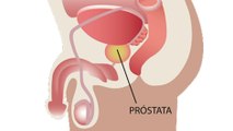 bd-hablamos-del-cancer-de-prostata-011121