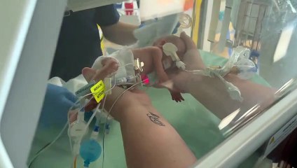 Follow the progress of our Milton Keynes miracle twins