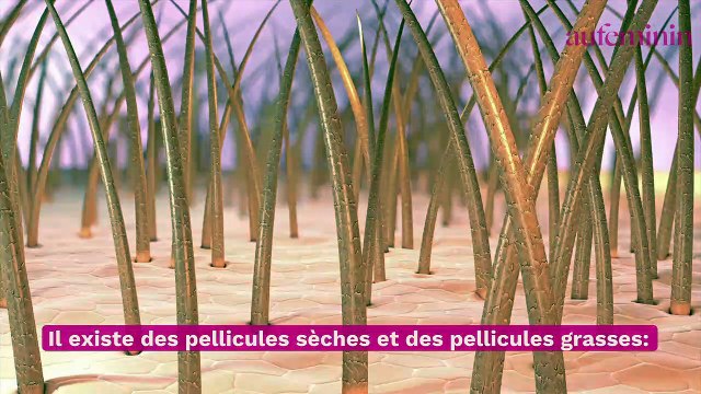 Comment enlever ses pellicules ? Conseils et traitements