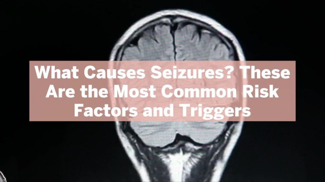 What Causes Seizures? These Are the Most Common Risk Factors and Triggers, According to Experts