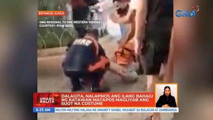 Dalagita, nalapnos ang ilang bahagi ng katawan matapos magliyab ang suot na costume | UB