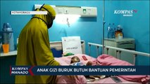 Anak Gizi Buruk Butuh Bantuan Pemerintah