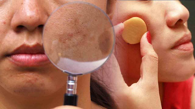 चेहरे पर आलू का रस लगाने से क्या होता है | चेहरे पर आलू घिसने से क्या होता है | Boldsky