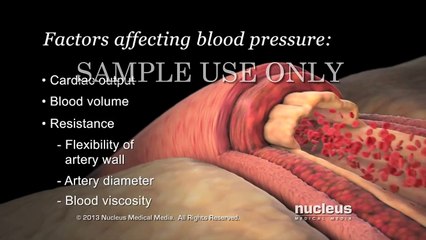 Nucleus - High Blood Pressure