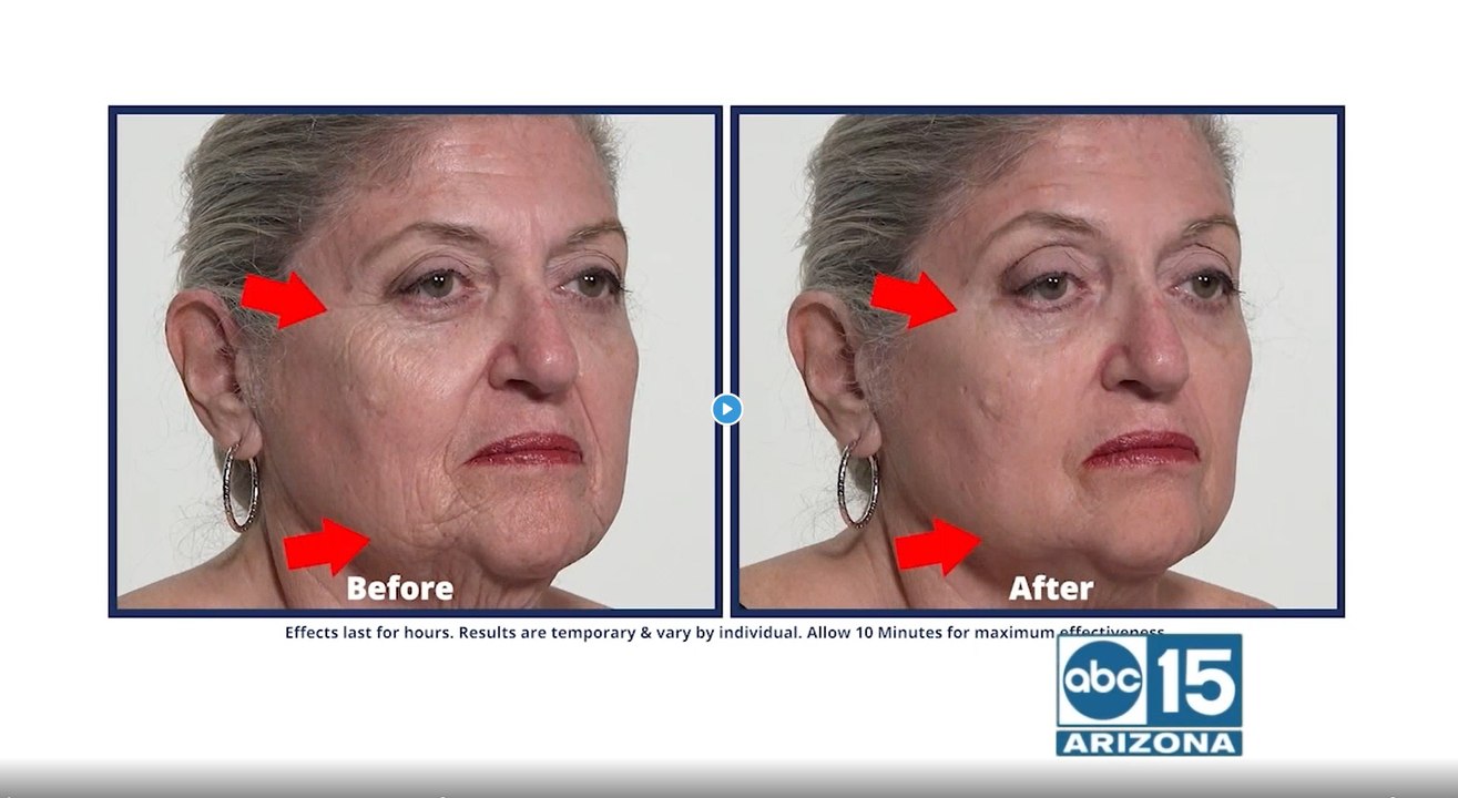 How you can look younger in just 10-minutes with Plexaderm