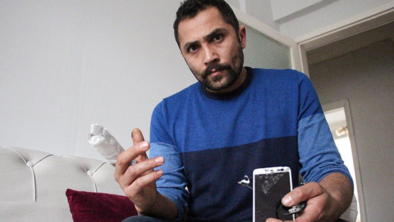 Bomba gibi patlayan powerbank parmağını kopardı