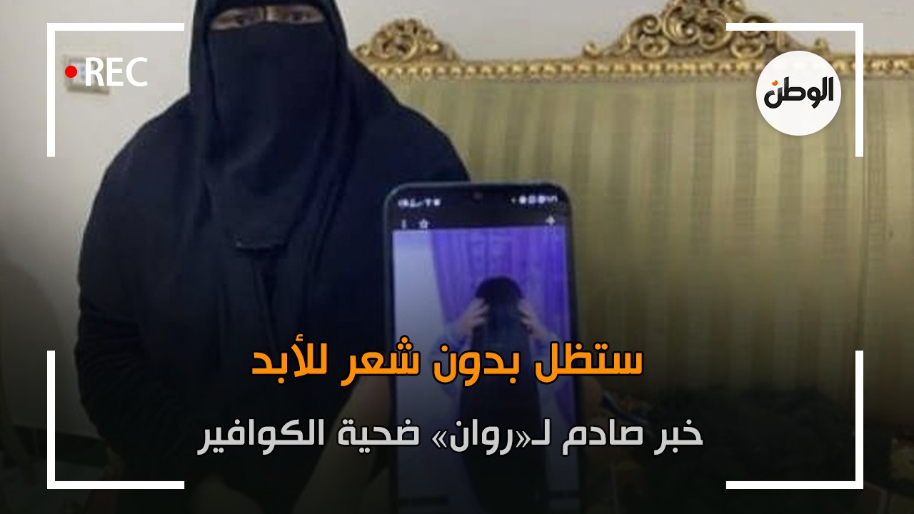 خبر صادم لـ روان ضحية الكوافير.. ستظل بدون شعر للأبد