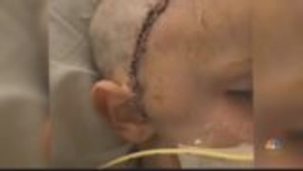 Family Hopeful Little Boy Battling Aggressive Brain Fungal Infection Will Recover
