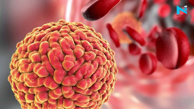 30 more test positive for Zika virus in UP’s Kanpur, tally reaches 66