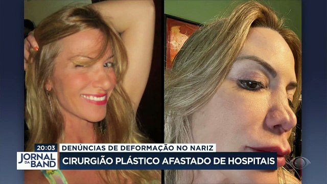 Um renomado cirurgião foi afastado de três dos principais hospitais de São Paulo. Mais de 30 pacientes denunciaram que ficaram com o nariz deformado após fazerem plástica com o médico.