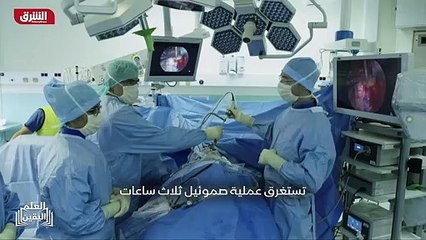 ...لا يحتاج الدكتور كونان سوى الى ثلاثة مدا...