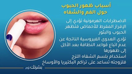 أسباب ظهور الحبوب حول الفم وطرق علاجها