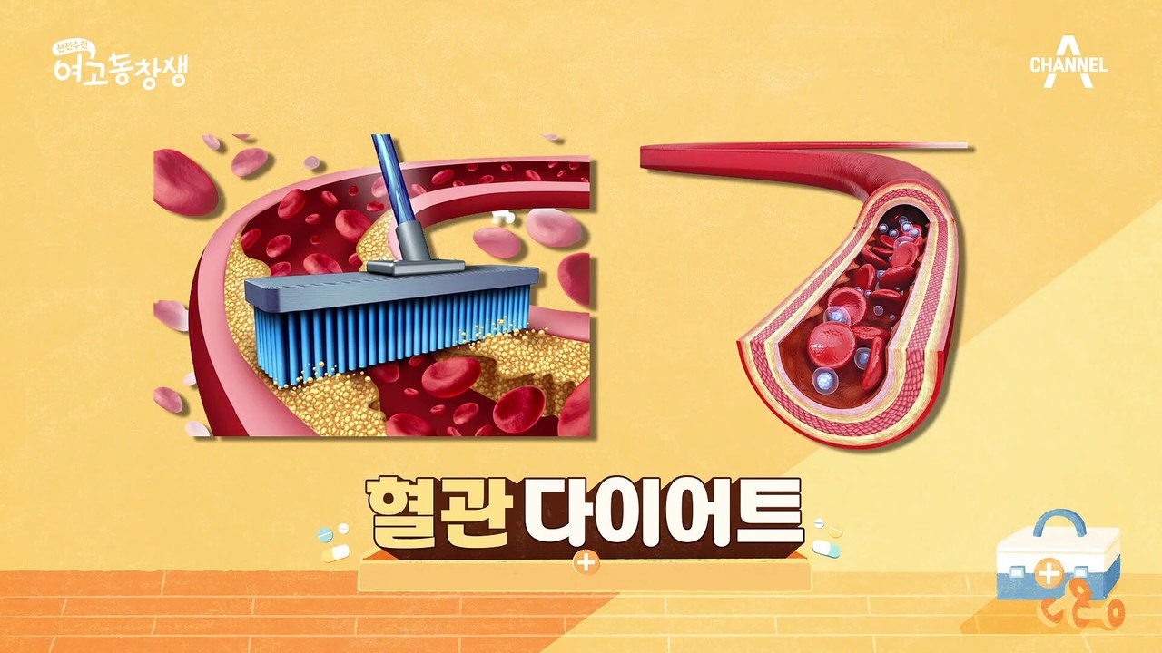 나의 혈관 건강을 자가 검진을 통해 알아본다? 비만 잡고 혈관 건강 지키는 방법!