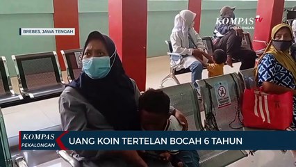 Uang Koin Tertelan Bocah 6 Tahun