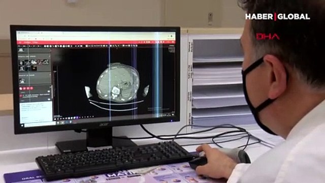 Ödüllü araştırma ilk kez ortaya çıkardı: Koronavirüs kalp hastalıkları ve kanserden koruyan sistemin 'şalterlerini' kapatıyor