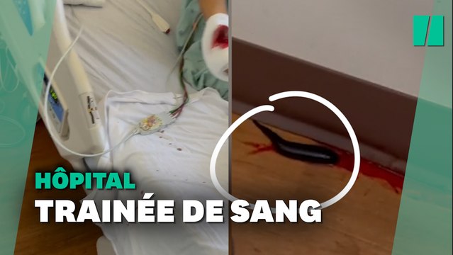 Cet animal a transformé une chambre d'hôpital en film d'horreur