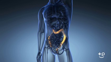 Colon Cancer - Occurrence