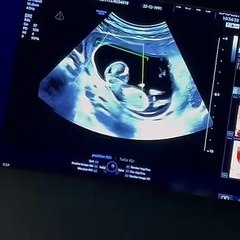 Nehuda révèle attendre son deuxième enfant avec son compagnon Ricardo Pinto.