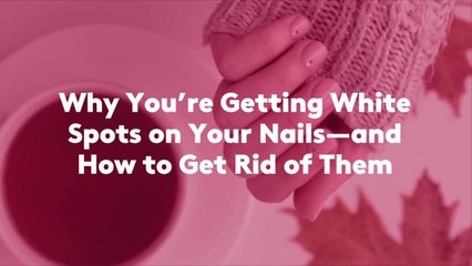 Why You're Getting White Spots on Your Nails—and How to Get Rid of Them
