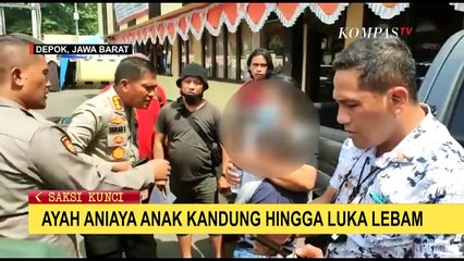 Bocah 8 Tahun di Depok Bonyok Dipukili Ayahnya yang Mabuk