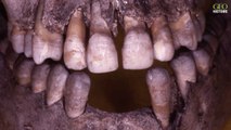 Origine des Amérindiens : une nouvelle analyse de dents bouscule une théorie répandue