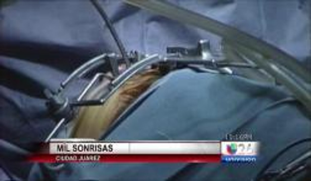 Operaciones gratuitas para niños con paladar endido y labio leporino