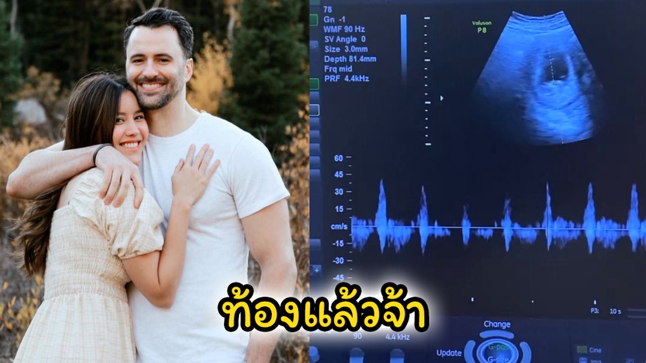 หญิง พลอยชมพู น้องสาวกอล์ฟ-ไมค์ ประกาศข่าวดีเบบี๋มาแล้วจ้า