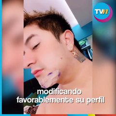 Mario Aguilar presume increíble cambio físico tras cirugía plástica