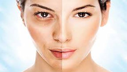 चेहरे पर भूरे धब्बे हो सकते हैं गंभीर बीमारी का संकेत, जानें कारण। Boldsky