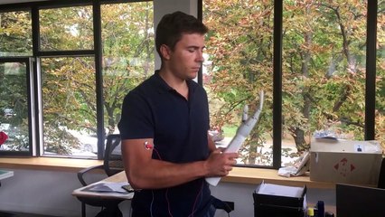 The prototype of the bionic prosthetic hand