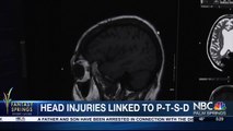 YOUR HEALTH TODAY: Brain injury linked to P-T-S-D