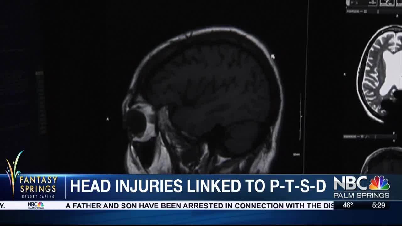 YOUR HEALTH TODAY: Brain injury linked to P-T-S-D