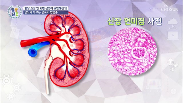 당뇨보다 더 무서운 합병증☠ 당뇨 증상을 의심하라 TV CHOSUN 20211111 방송