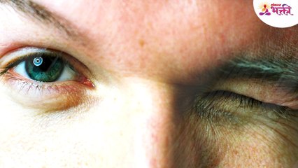 अचानक 'डोळा लवणे' कसला संकेत असतो?