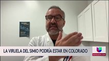 La viruela del simio podría estar en Colorado