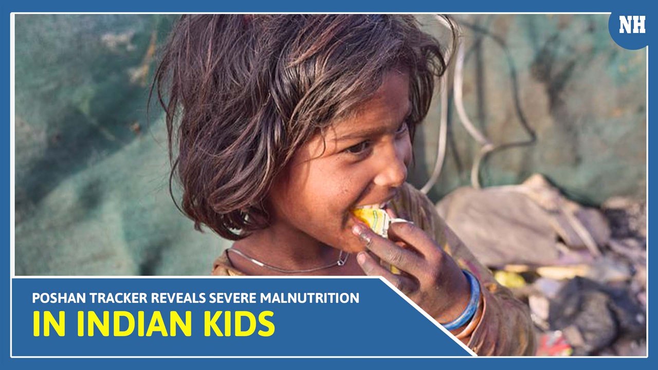 Malnutrition in India: More than 33 lakh children in the country are malnourished