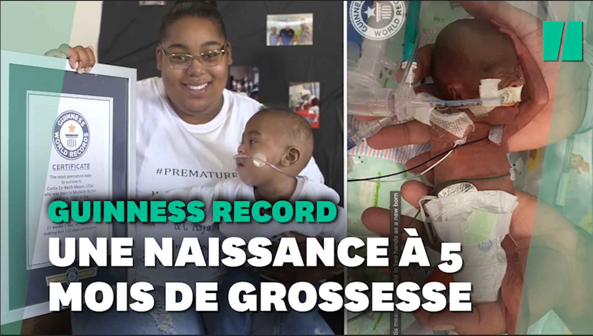 Aux Etats Unis Ce Bebe Est Le Plus Grand Premature Au Monde Apres 5 Mois De Grossesse Video Dailymotion
