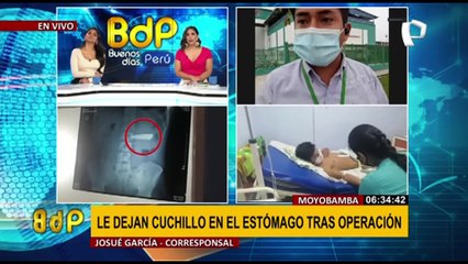 Moyobamba: médicos le dejan cuchillo en el cuerpo durante operación
