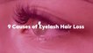 9 Causes of Eyelash Hair Loss