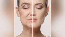 Lipid क्या है, Face Ageing से LIPID कैसे बचाता है | Face Wrinkles Home Remedy | Boldsky