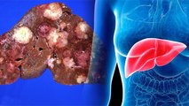 Liver खराब होने पर आप हो सकते हैं इन भयंकर बीमारियों के शिकार | Boldsky